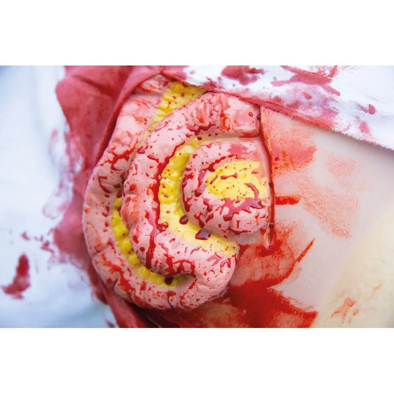 Wound Moulage Protruding of small and large intestines