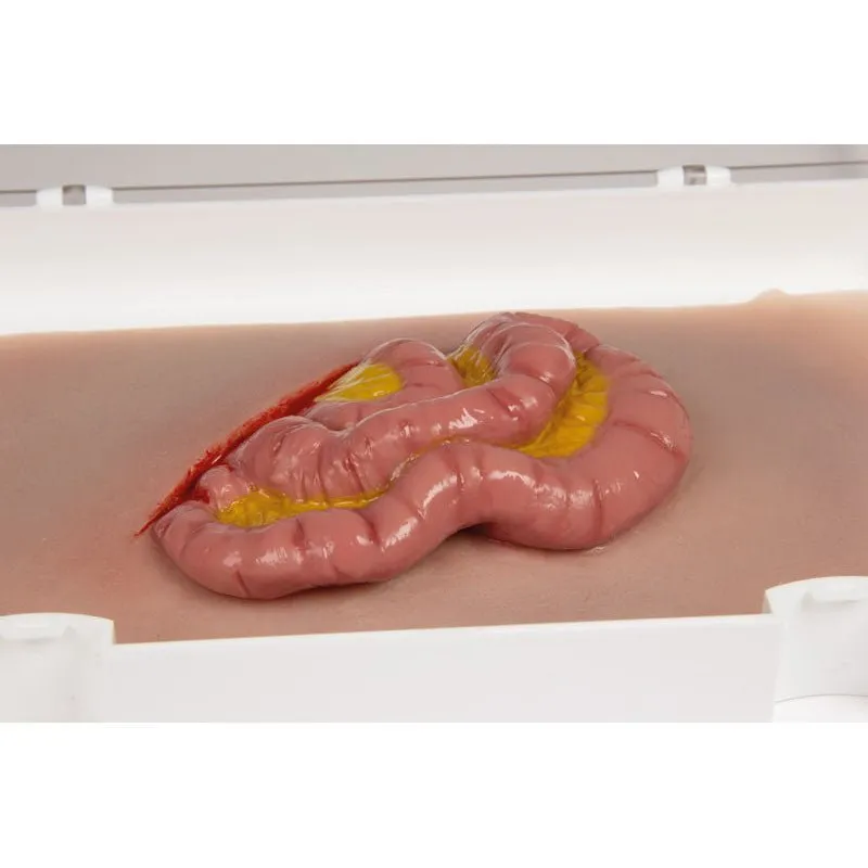 Wound Moulage Protruding of small and large intestines