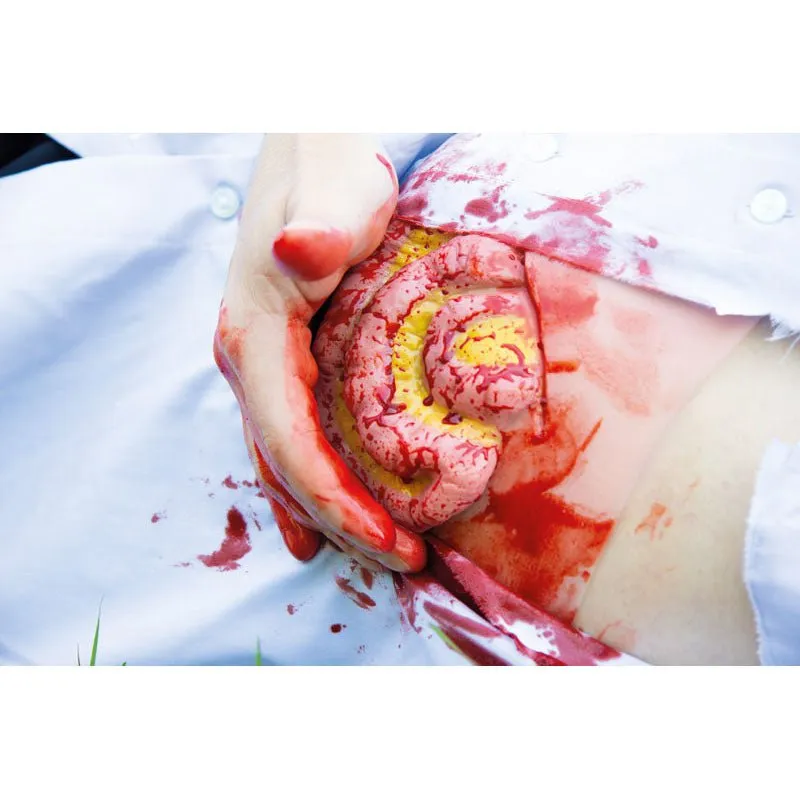 Wound Moulage Protruding of small and large intestines